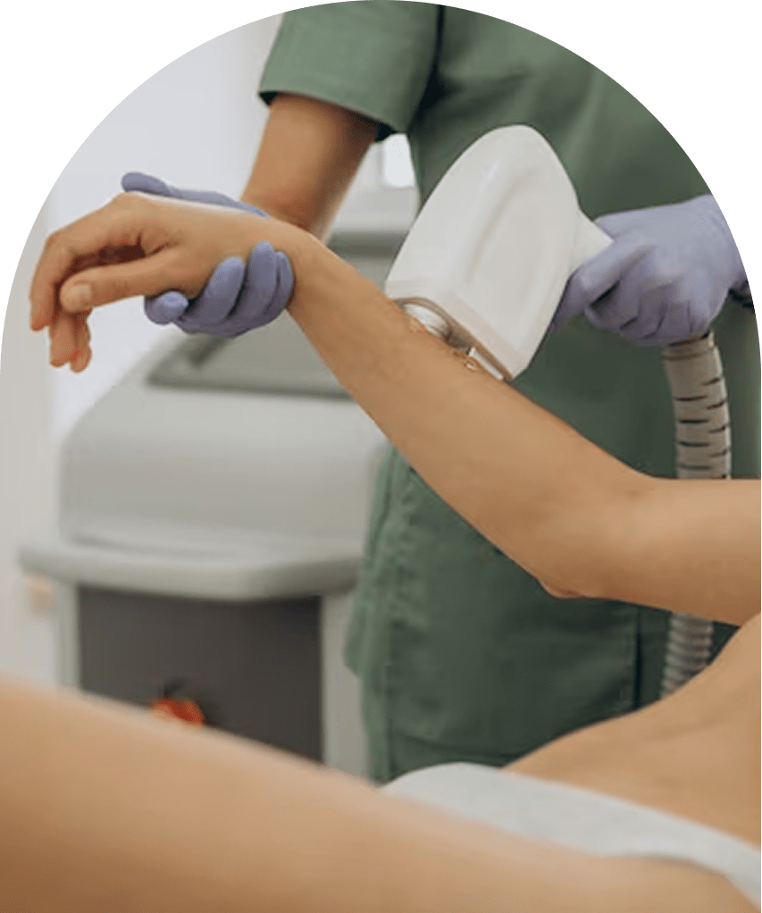 Laser Hair Removal