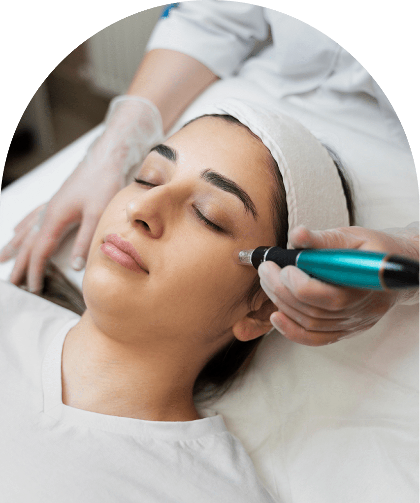 Microneedling Facial